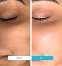 smvera gold beauty cream