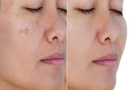 smvera gold beauty cream